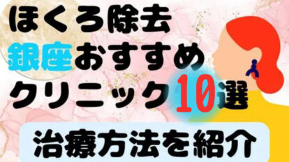 ほくろ除去　銀座おすすめ