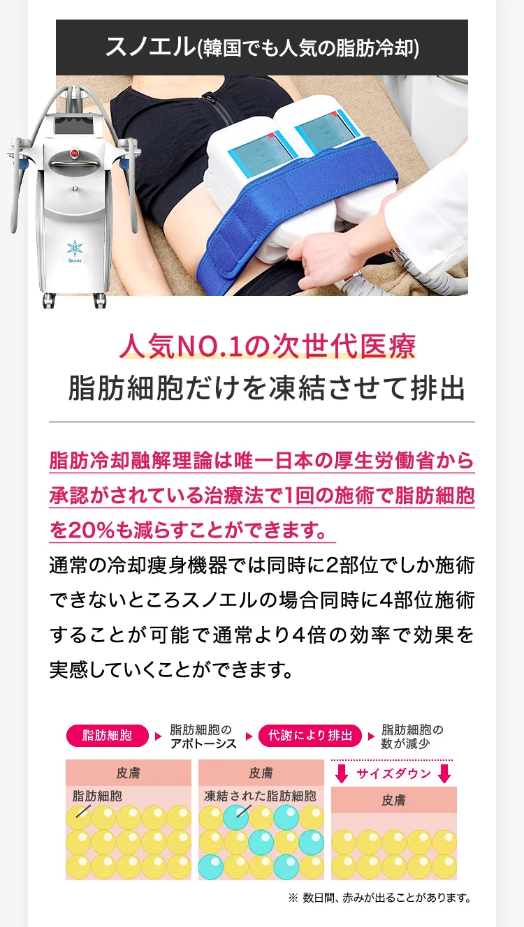 スノエル（脂肪冷却装置）