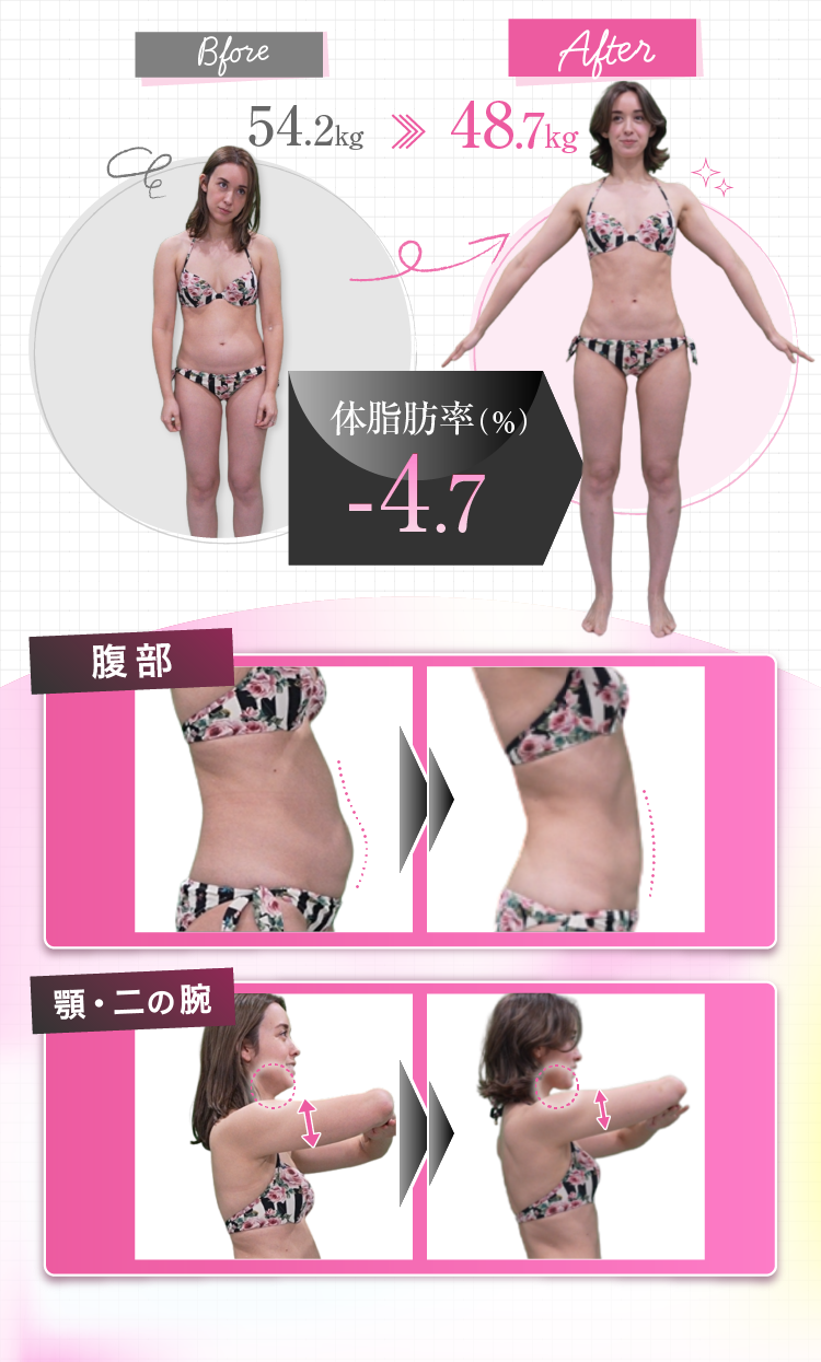 URARAクリニックでダイエットに対する意識改革
