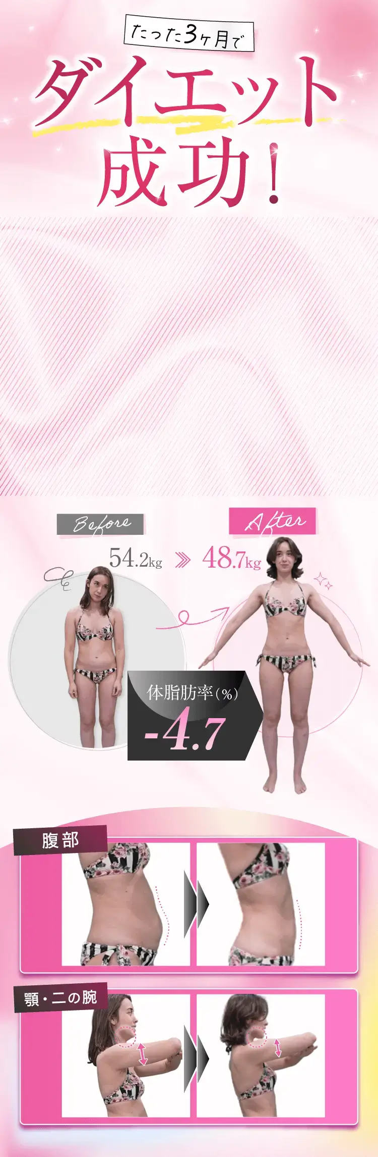 先着5名様限定／初めての医療美痩身／本気のダイエットを応援