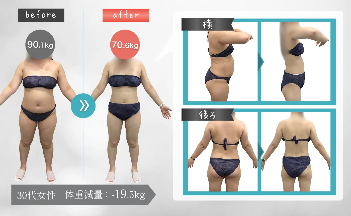 30代女性 体重減量：-19.5kg