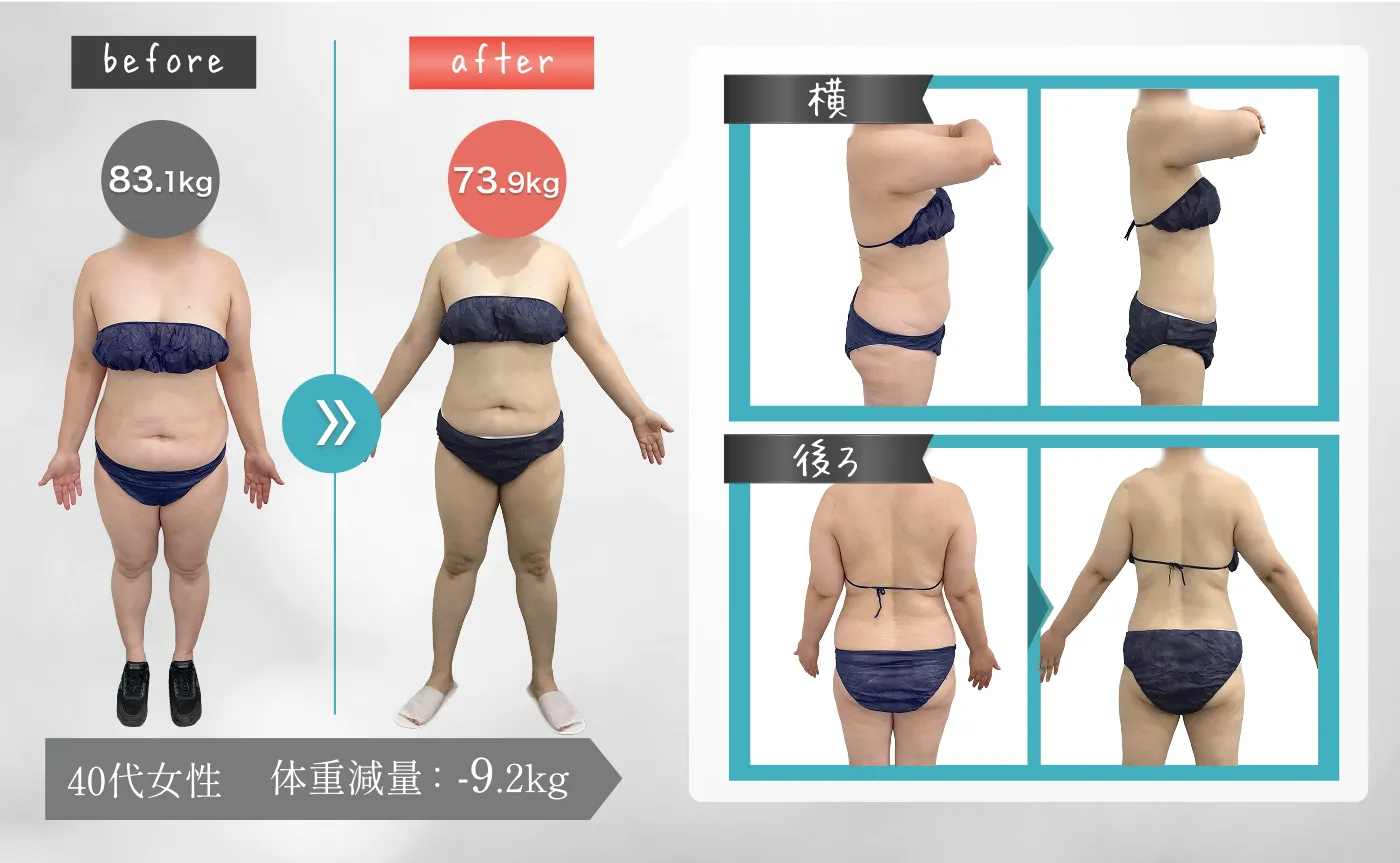 40代女性 体重減量：-9.2kg