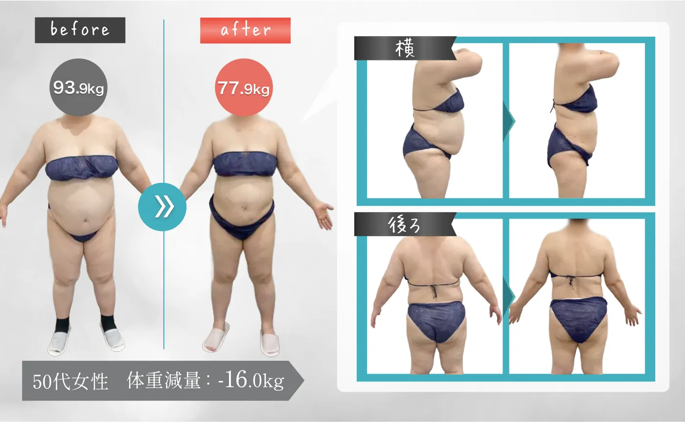 50代女性 体重減量：-16.0kg