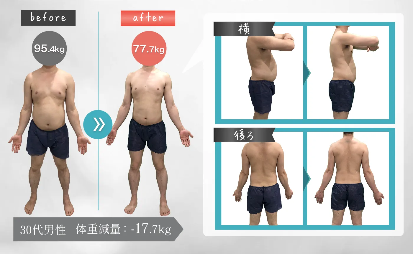 30代男性 体重減量：-17.7kg