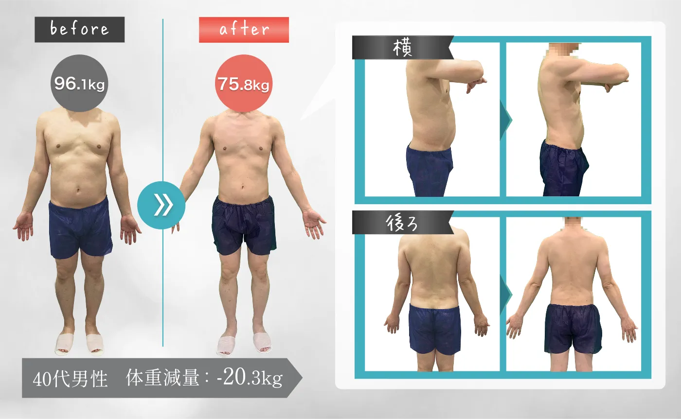 40代男性 体重減量：-20.3kg