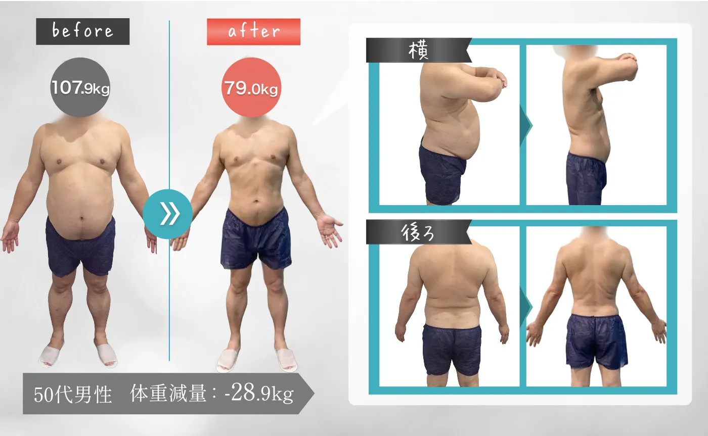 50代男性 体重減量：-28.9kg