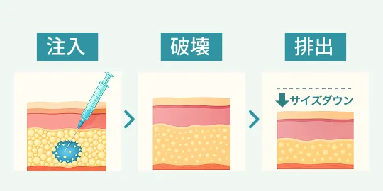 脂肪溶解注射のメカニズム02