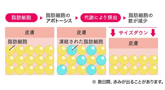 脂肪冷却のメカニズム02