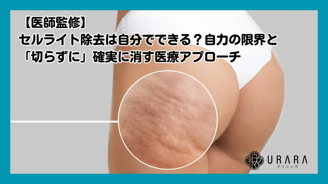 医師監修】セルライト除去は自分でできる？自力の限界と「切らずに
