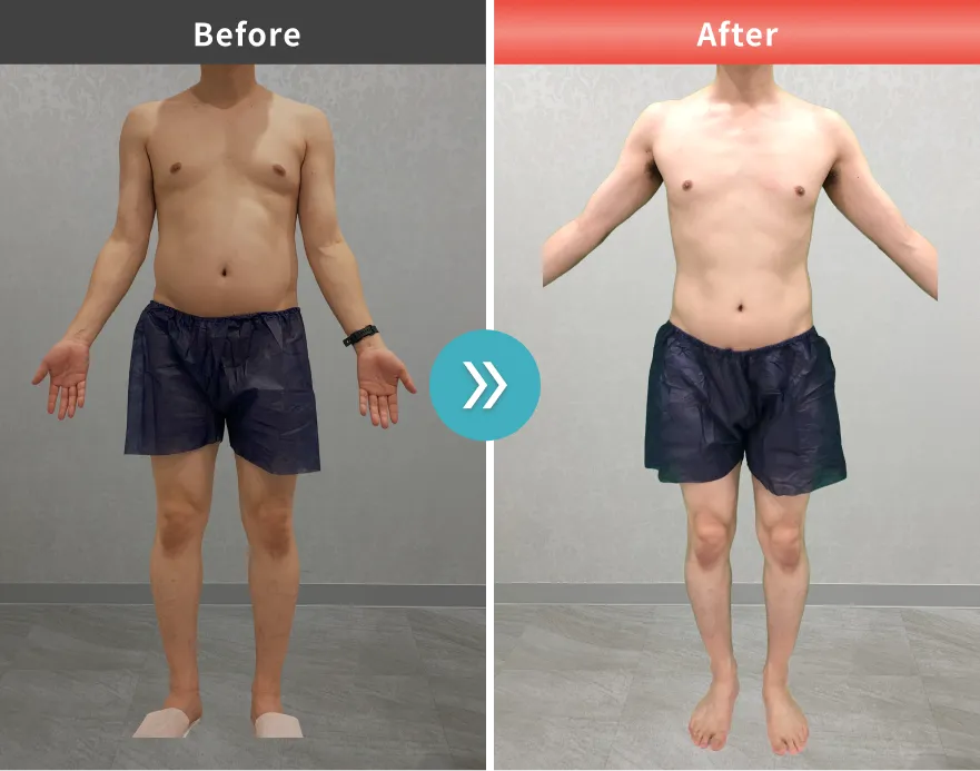 医療痩身・医療ダイエットの症例No.0005｜96.1kg→75.8kg（40代男性・176cm）