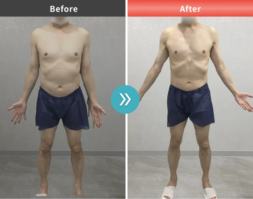 医療痩身・医療ダイエットの症例No.0070｜80.1kg→71.7kg（50代男性・183cm）