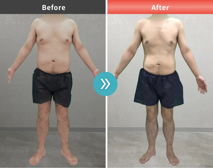 医療痩身・医療ダイエットの症例No.00116｜70.3kg→60.2kg（40代男性・165cm）