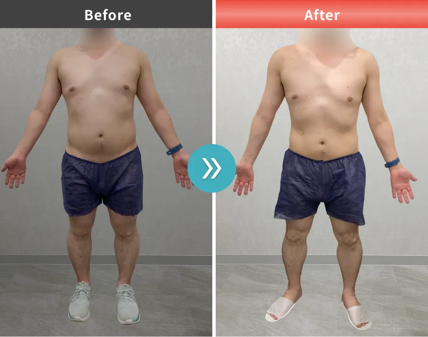 医療痩身・医療ダイエットの症例No.00154｜90.6kg→82.8kg（30代男性・172cm）