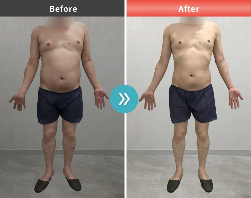 症例No.00192｜102.7kg→86.8kg（40代男性・181cm）