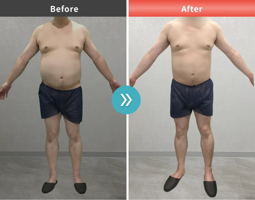 症例No.00194｜93.4kg→88.7kg（40代男性・177cm）