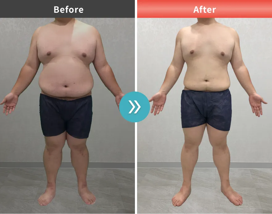 症例No.00197｜125.5kg→104.2kg（20代男性・173cm）