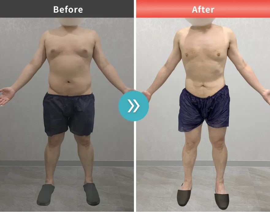 症例No.00204｜79.4kg→65.3kg（40代男性・162cm）