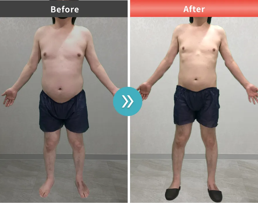症例No.00206｜78.4kg→69.7kg（40代男性・170cm）