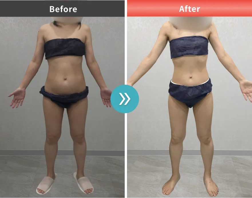 症例No.00208｜53.1kg→46.7kg（40代女性・159cm）