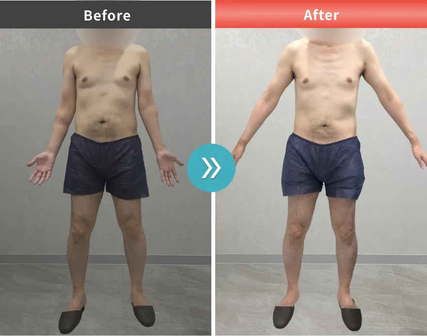 症例No.00209｜82.2kg→75.7kg（50代男性・178cm）